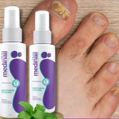 Medinall® Spray Para Hongos Natural, original e importado EE.UU (Mejora en 3 días)