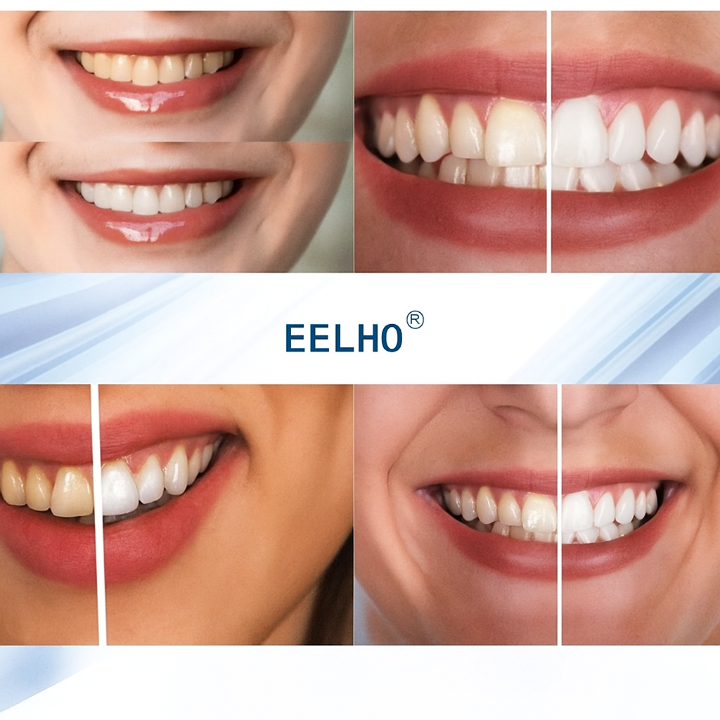 Lápiz Blanqueador dental natural en 3 días.... Pago contra entrega y envió gratis en Guatemala!!!!!